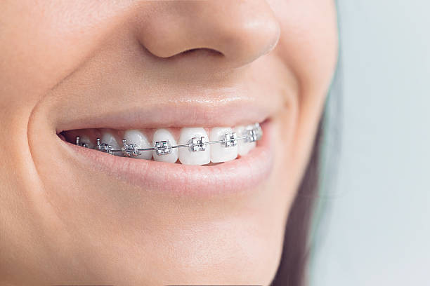 Best Traditional Braces  in Durham, NC